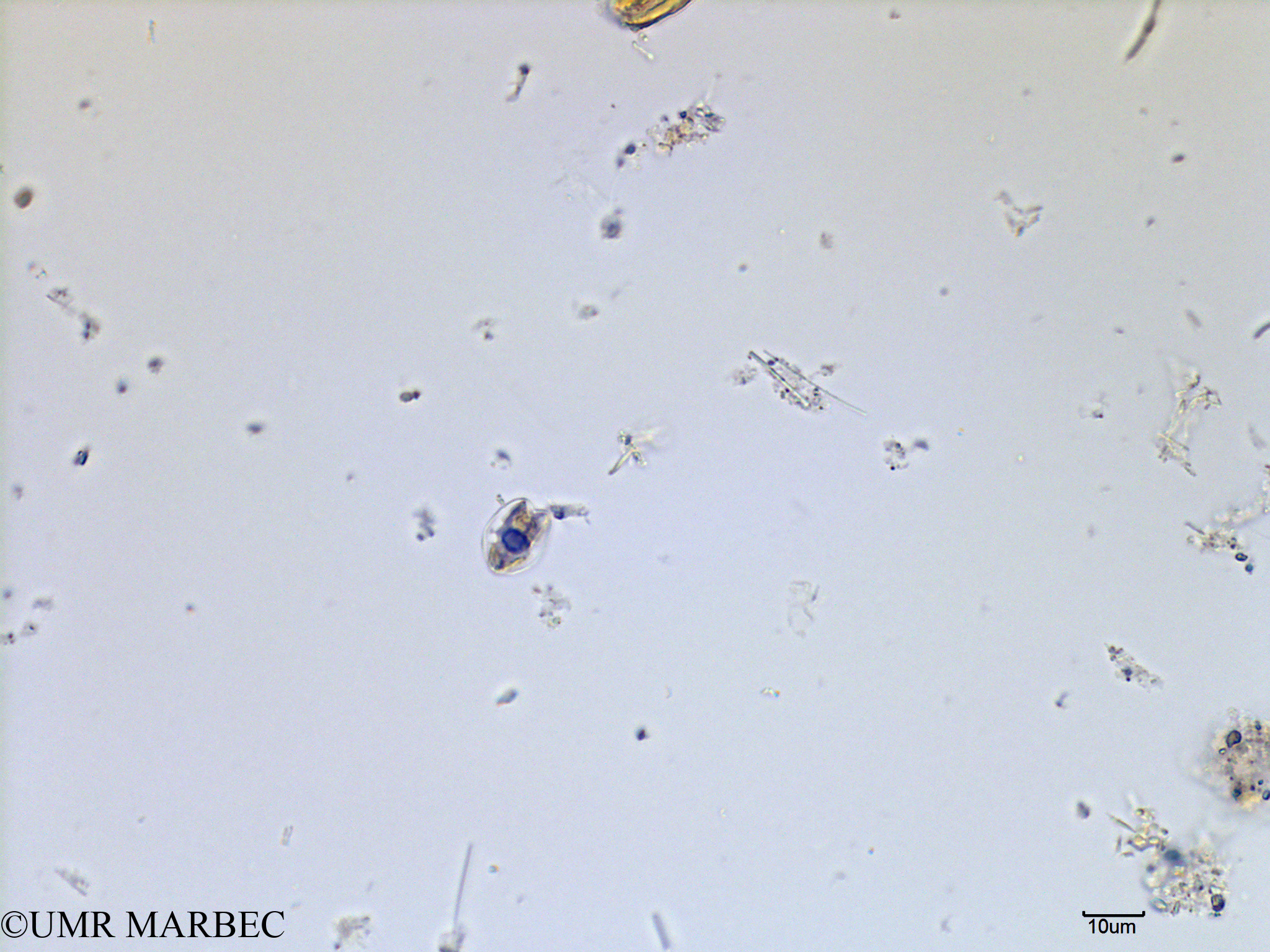 phyto/Scattered_Islands/mayotte_lagoon/SIREME May 2016/Nanoflagellé 6 (MAY8_flagelle bdd).tif(copy).jpg